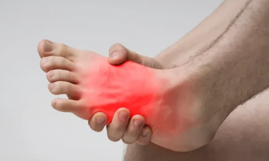 Foot with pain highlighted across the midfoot