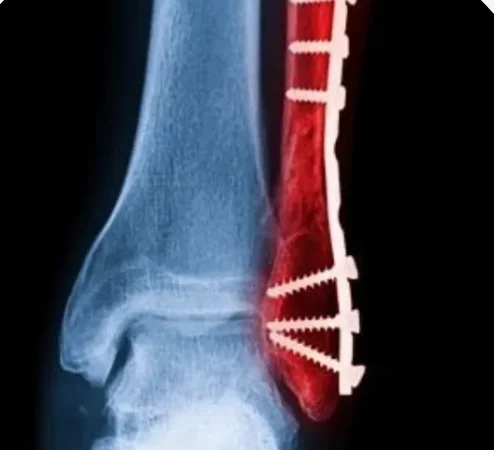 ankle
